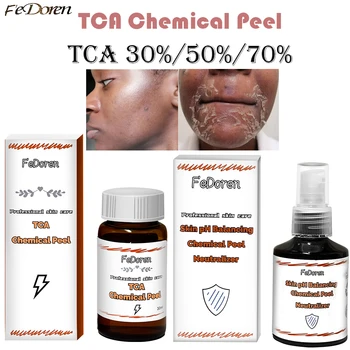30 ml de TCA Peeling Químico 70% de Tca Ácido Peeling de Ácido neutralizador de conjunto de la piel Superfuerza Descamación de la Pigmentación de la Cicatriz del Acné Iluminar